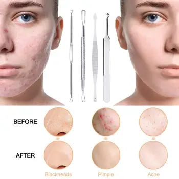Facial Cleansing Børste 5-i-1 El-Facial Massageapparat med 10stk/set Hudorm Remover Needls Pore Renere for Skønhed Huden Pleje