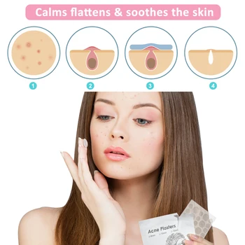 144 PachesAcne Bums Lappe Gips Tea Tree Skin Tag Plasteret Acne Creme Hydrocolloid Master Anti-infektion Hurtig Absorbere ansigtspleje