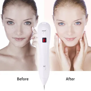 LCD-Ansigt, Hud, Mørk Plet Remover Muldvarp Fjernelse af Tatoveringer med Laser, Plasma-Pen Maskine Facial Fregne Tag Vorte Fjernelse skønhedspleje