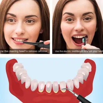 YJK031 Elektriske Ultralyd Tand Renere Husstand Tandsten Fjerner Tandsten Dental Snavs Fjernelse af Artefakt