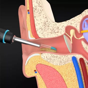 XIAOMI MIJIA Intelligent visuelle øre-picking stang 300W høj præcision endoskop med 350mAH magnetisk opladning base